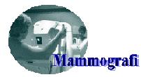 mammo1.jpg (5043 bytes)